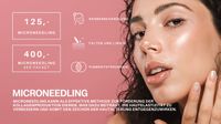 microneedling